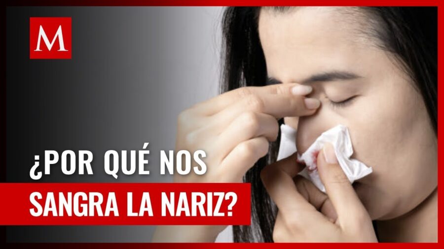 Descubre por qué puedes experimentar sangrado nasal repentino sin razón