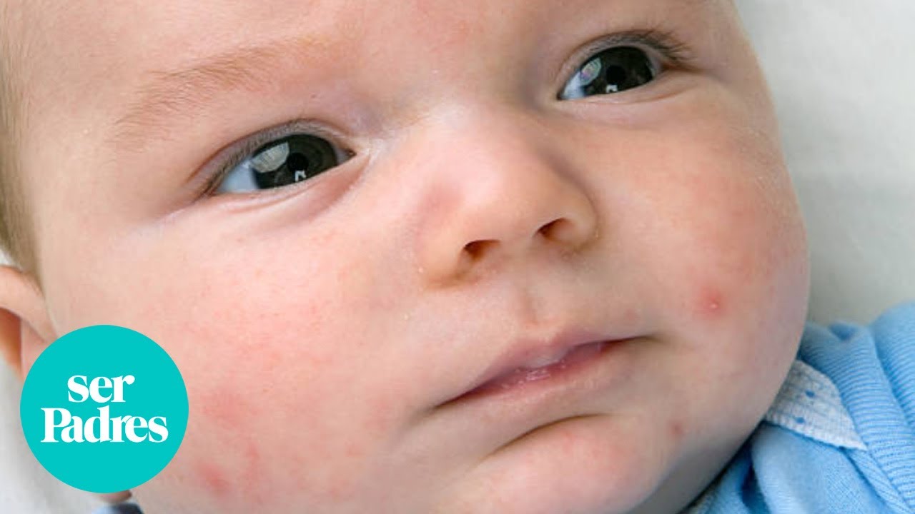 Descubre qué significa si tu bebé tiene puntitos rojos en la cara y cómo solucionarlo